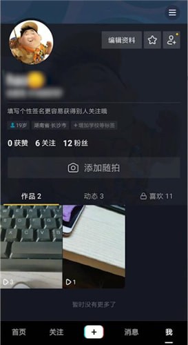 抖音作品和动态有什么区别